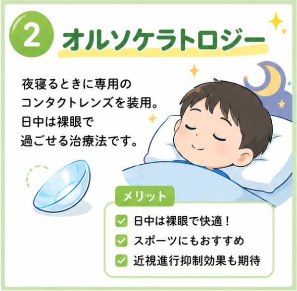 オルソケラトロジー